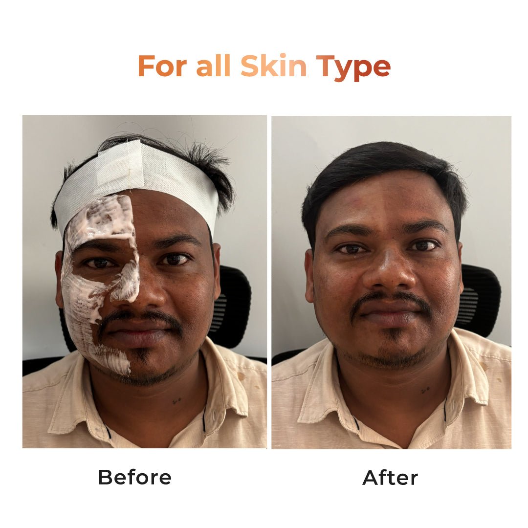 Niconi Tan Vanish Gluta - Kojic Skin Polish 180g - lifeGlow