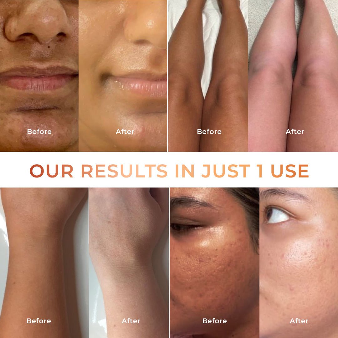 Niconi Tan Vanish Gluta - Kojic Skin Polish 180g - lifeGlow